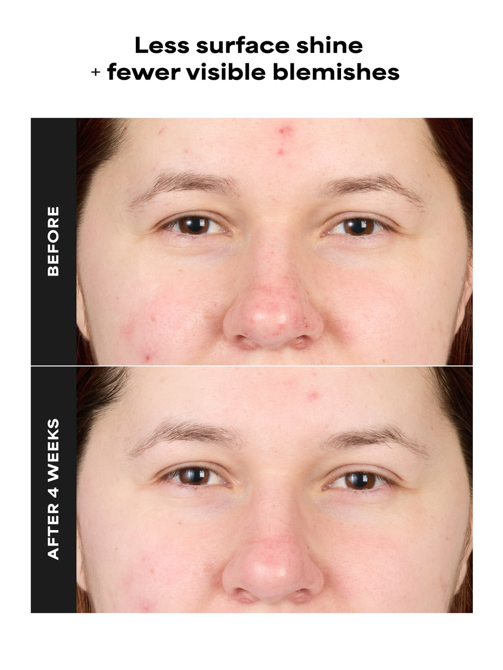 https://www.paulaschoice.com/dw/image/v2/BBNX_PRD/on/demandware.static/-/Sites-pc-catalog/default/dw30d964cd/images/products/8070_b_B&A-01.png?sw=1000&sfrm=jpg